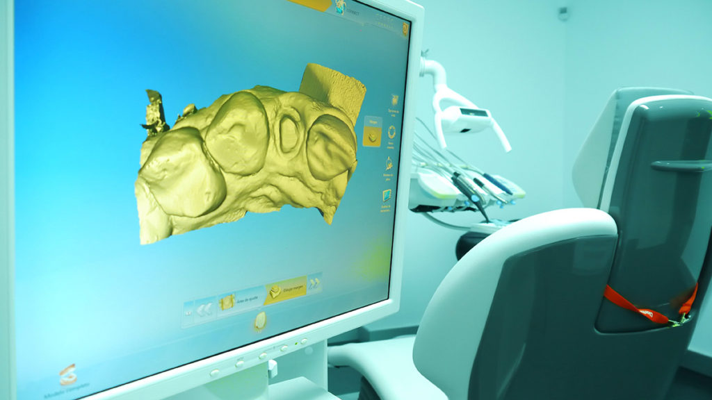 Computer Guided Dental Implant Surgery Dental Treatment In Spain